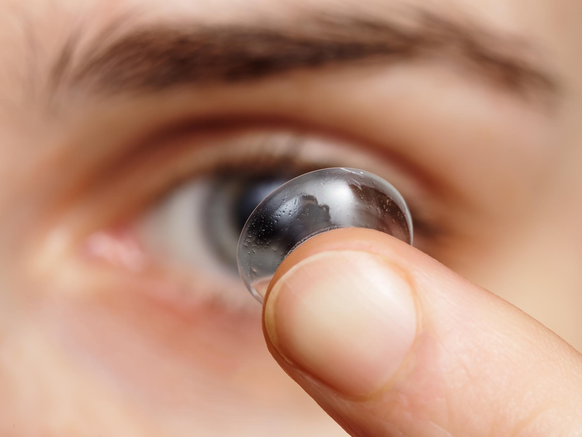 Contact lens examination at NORViSTA Eye Care