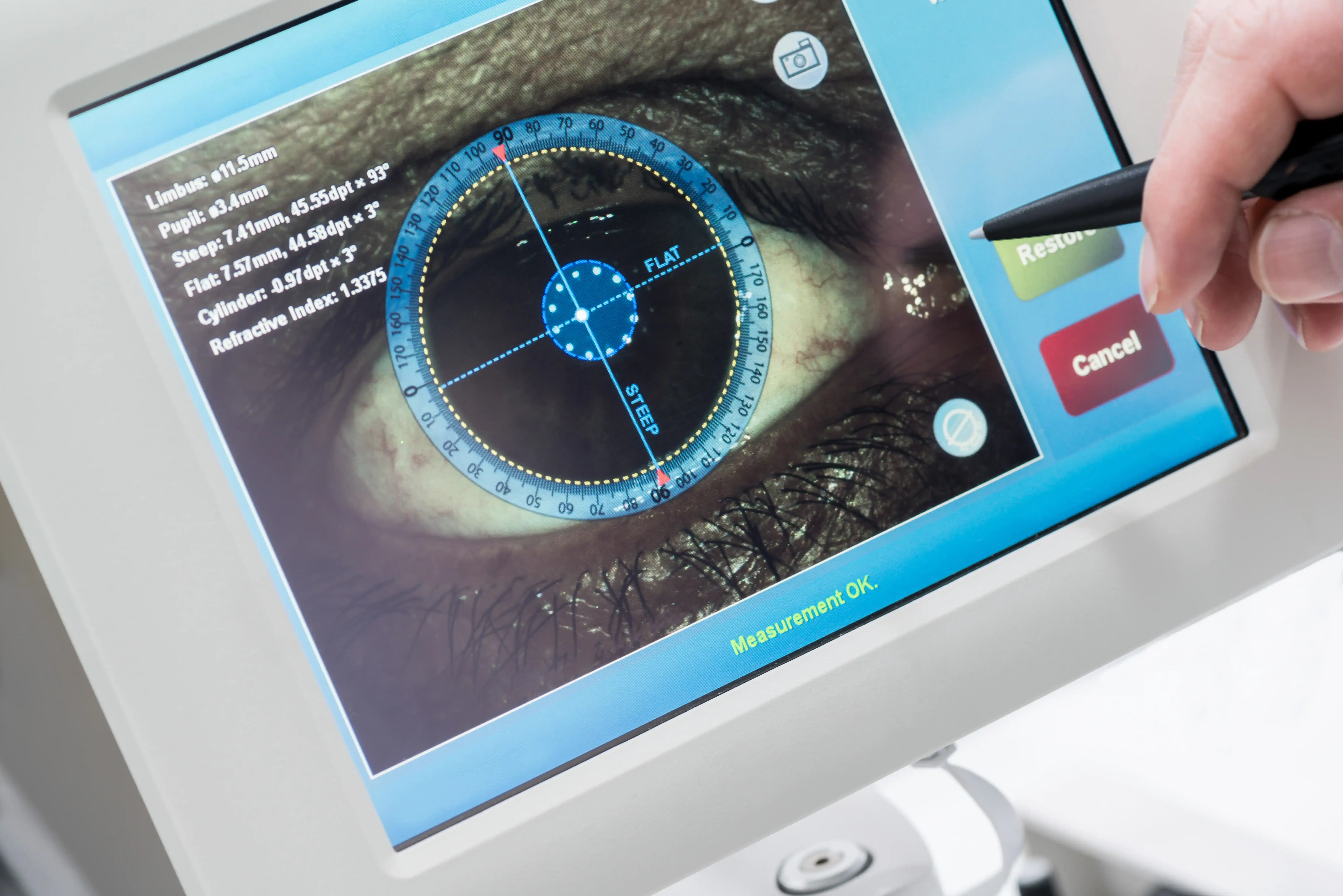Advanced glaucoma diagnostic imaging